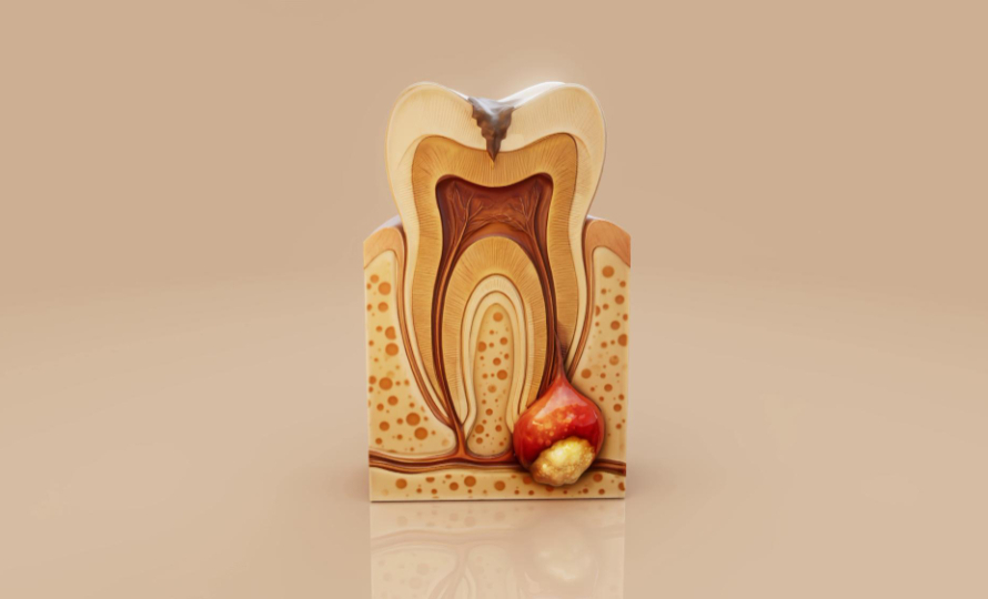 Learn how to treat early cavities before they worsen, including prevention tips, early dental treatments, and when to visit a dentist for lasting oral health.