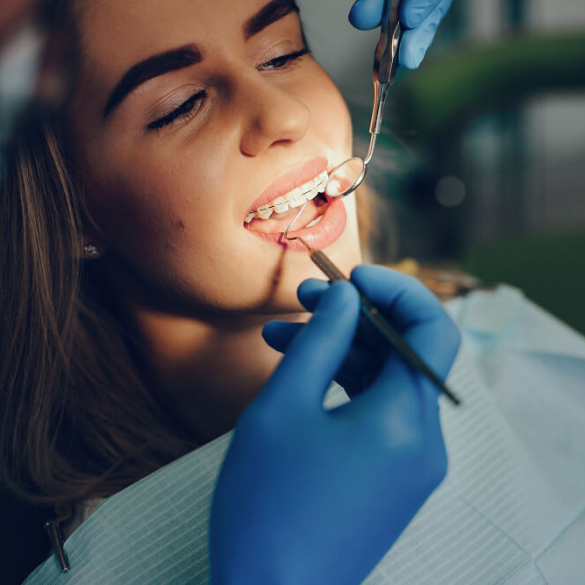 Ceramic Braces in Dubai